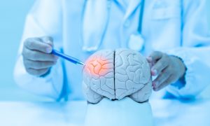 Neurologist hand pointing brain anatomy human model and brain disease lesion on white background.Part of human body model with organ system for health student study in university.Medical education.